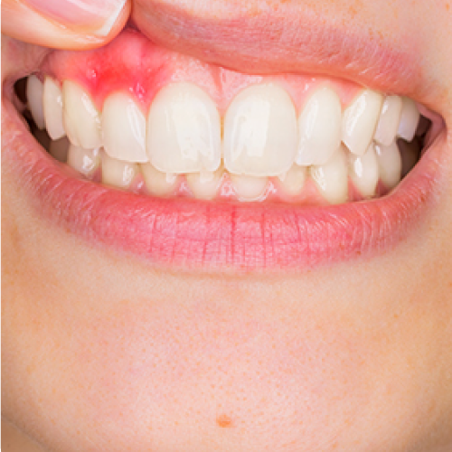 periodonci-4Ever-Dental